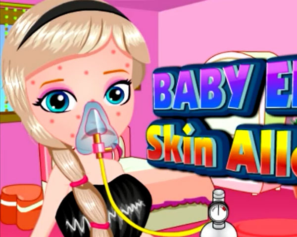Baby Elsa Skin Allergy